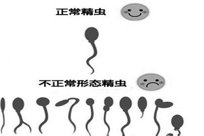 死精率80%的男性可以在滁州市做三代试管吗？公开2026做三代试管条件