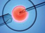 试管婴儿费用需要多少？多少天能完成全部流程