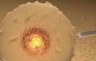 济南做试管婴儿成功率最高的医院是哪家？如何选择医院？